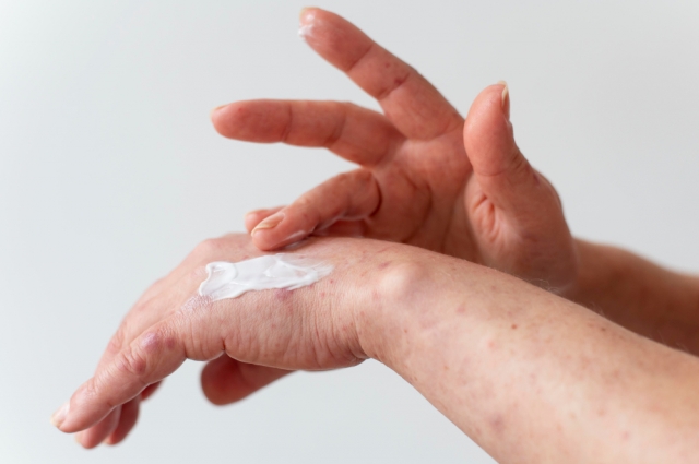 The Everyday Habits That Make Eczema Worse