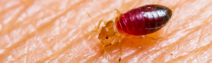 Treatments That Are Commonly Used For Bed Bug Bites by Bedbugs Exterminator Toronto 