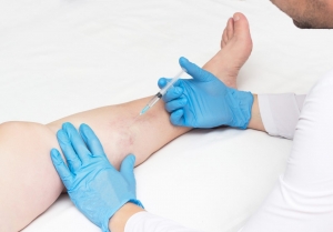 Why Should You Consider Checking Up With A Veins Doctor?