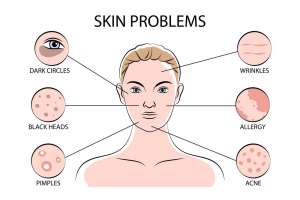 5 Proven Ways To Treat Skin Problems