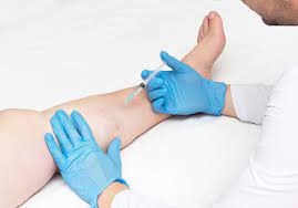 What Is The Process Of Laser Vein Treatment?