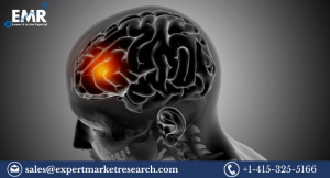 Global Atypical Teratoid Rhabdoid Tumours (ATRT) Treatment Market Size to Grow at a CAGR of 7.9% in the Forecast Period of 2023-2031