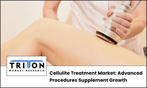 Cellulite Treatment Market: Advanced Procedures Supplement Growth