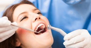 What Happens If You Leave A Root Canal Untreated in Dubai