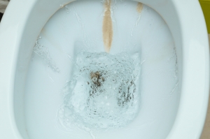 Removing Rust Stains From Toilets
