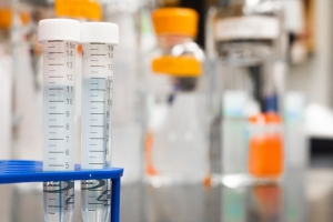 What is a Laboratory Information System? What is a Laboratory Information System?