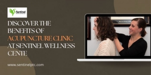 Discover the Benefits of Acupuncture Clinic at Sentinel Wellness Center