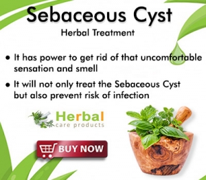 10 Effective Home Remedies for Treating Sebaceous Cysts