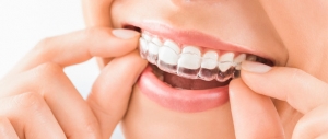 Braces in Bankstown: Six signs to Consider