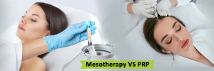Mesotherapy for Hair Loss: A Proven Solution for Thicker, Healthier Hair