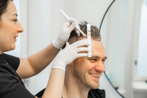 Exploring the Possibilities of Male Hair Transplant in Dubai