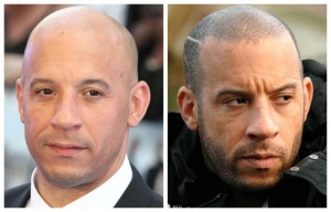The Ultimate Guide to Transform Your Look with Scalp Micropigmentation Treatment