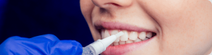 Tooth Fillings: Three Things You Need To Know