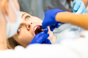 tooth extraction in Camarillo