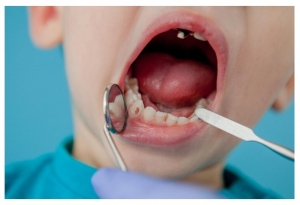 How Bad Oral Hygiene Can Lead to Oral Cancer