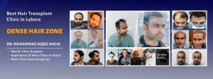 Hair Transplantation in Lahore: Restoring Confidence and Natural Hair