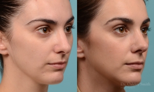 5 Powerful Reasons Why a Plastic Surgeon in Lahore Pakistan Can Transform Your Life