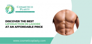 Best Liposuction in Lahore at an Affordable Price