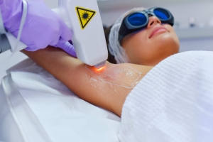 LASER HAIR REMOVAL - ANSWERS TO FREQUENTLY ASKED QUESTIONS
