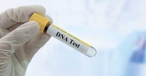 How Can We DNA Testing with an Image?