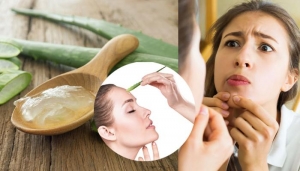 How Are Some Herbal Remedies Working to Clearing Up blemishes?