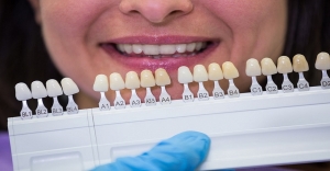 Transforming Your Smile with Composite Bonding and Implant Dentistry!