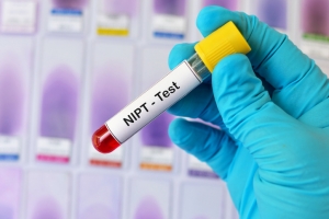 NIPT (Noninvasive Prenatal Testing): What You Need to Know