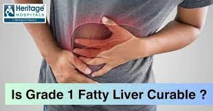 Understanding Fatty Liver Grade 1: Causes, Symptoms, and Management